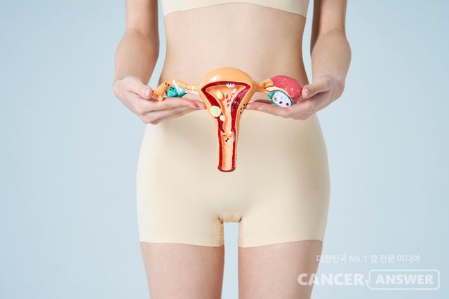 자궁 안에 존재하는 특정 유익균이 자궁내막암의 재발 위험과 연관돼 있으며, 항암 면역반응 활성화에도 관여한다는 국내 연구 결과가 나왔다.&nbsp;연구팀은 예후가 좋고 재발 위험이 낮은 자궁내막암 환자군에서 ‘바실러스 메가테리움(Bacillus megaterium)’이라는 유익균이 상대적으로 많이 존재한다는 점을 확인했다./게티이미지뱅크