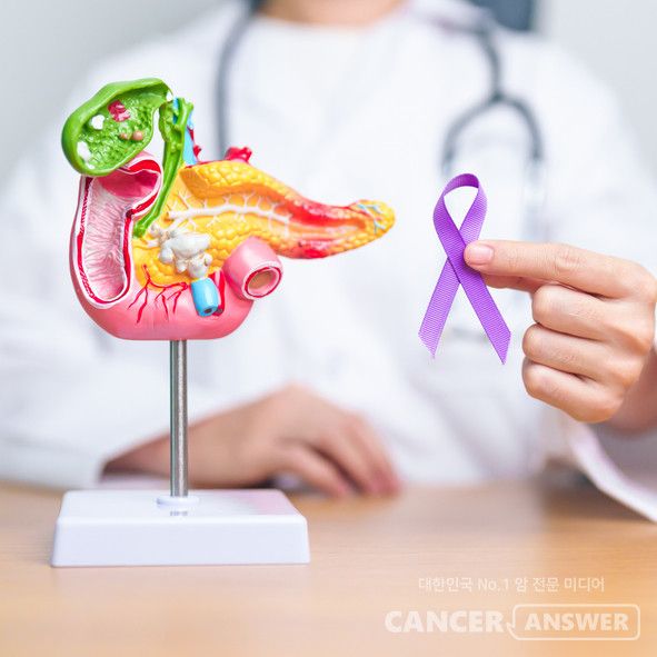 글로벌 3상 임상시험에서 생존기간 연장 효과를 입증한 다락손라십, 최근 유럽종양학회 소화기암학술대회에서 병용요법 객관적 반응률(ORR) 82%를 발표한 졸돈라십이 췌장암 치료의 새 가능성을 보여주고 있다./게티이미지뱅크