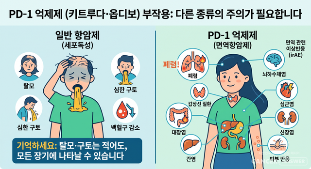 세포독성항암제와 PD-1 억제제(키트루다, 옵디보) 부작용 비교./AI 자료