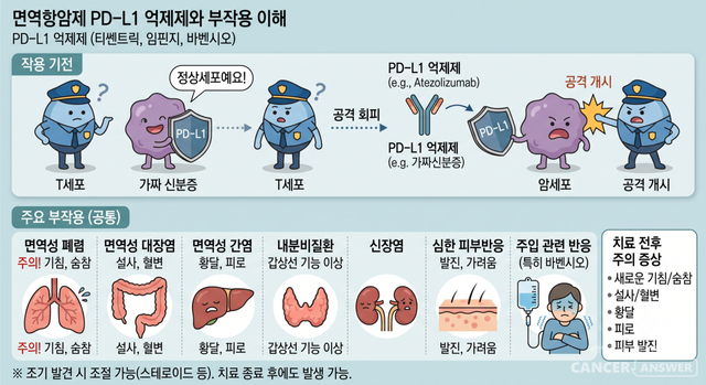 PD-L1 억제제의 가장 큰 특징은 면역성 폐렴을 항상 염두에 둬야 한다는 점이다. 임핀지는 수술이 어려운 3기 비소세포폐암 환자에서 항암방사선치료 후 재발을 줄이기 위한 유지요법으로 널리 사용되는데, 폐암 환자에서는 면역성 폐렴과 방사선폐렴, 일반 폐렴을 구별하는 것이 매우 중요하다. PD-L1 억제제의 주요 부작용./AI이미지