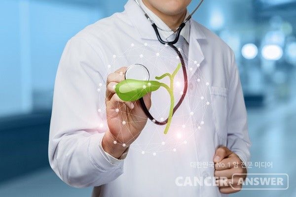 연세암병원 종양내과 이충근·최혜진 교수 연구팀은 이전에 치료받지 않은 HER2 양성 진행성 담도암 환자를 대상으로 다기관 임상시험을 진행한 결과, HER2 표적치료제 트라스투주맙과 면역항암제 니볼루맙을 기존 항암화학요법에 병용했을 때 객관적반응률 55%를 기록했다고 23일 밝혔다. 담도암은 담관을 비롯해 담즙이 흐르는 담도계에 발생하는 암으로 간내담도암, 간외담도암, 담낭암 등을 포함한다./게티이미지뱅크