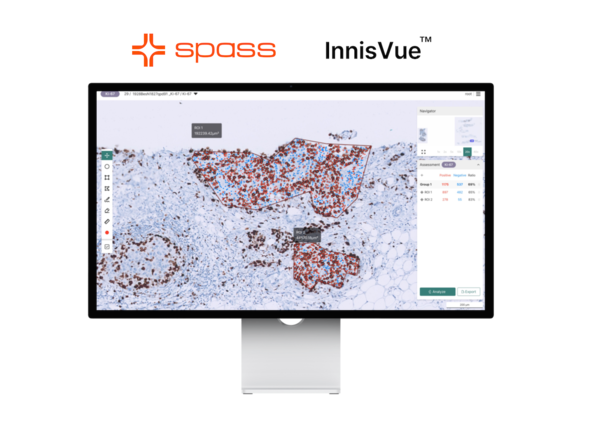 슈파스, 형태계측 AI 솔루션 '이니스뷰(InnisVue)' 식약처 허가 획득