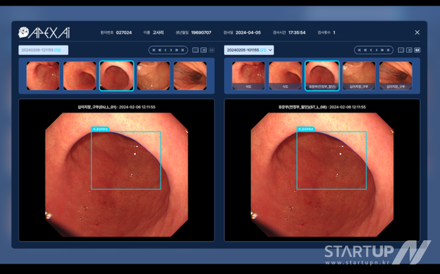 아펙스에이아이, 위암·대장암 조기 진단 AI 솔루션으로 글로벌 진출 가속