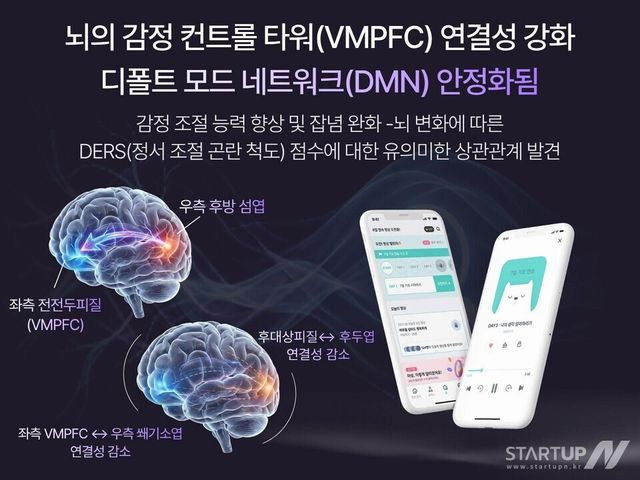 마보x세브란스병원 연구팀 fMRI 연구 결과 논문 공개