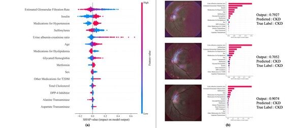설명 가능 AI 주요 위험 인자 기여도 시각화 결과