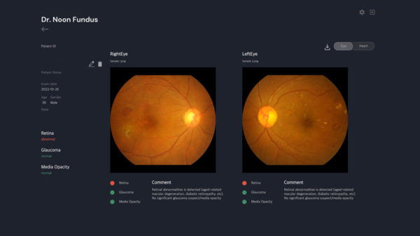 메디웨일, 혁신의료기기 통합심사 승인…‘닥터눈 펀더스’ 비급여 시장 합류