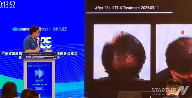 중국 광둥성 모발의학대회서 칼레심 임상결과 발표하는 김지석 교수. (제공= 키앤스톤)