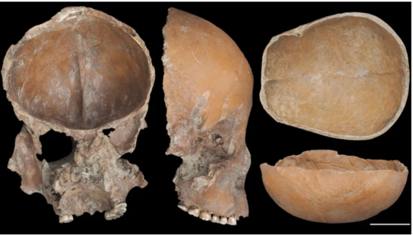 중국 신석기 유적에서 발견된 가면형 얼굴뼈. ⓒ데일리포스트=이미지 출처/Scientific Reports