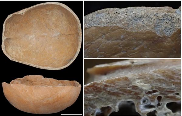 중국 신석기 유적에서 발견된 두개골 컵. ⓒ데일리포스트=이미지 출처/Scientific Reports