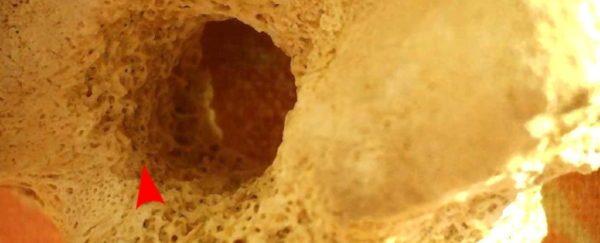 ⓒ데일리포스트=이미지 제공/International Journal of Osteoarchaeology