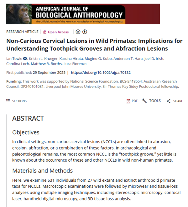 ⓒ데일리포스트=이미지 제공/American Journal of Biological Anthropology,&nbsp;2025