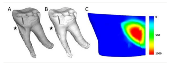 오랑우탄 어금니의 3D 모델 시뮬레이션. 치아 뿌리 부위(★)의 홈이 도구 사용 없이도 자연적인 마모로 형성될 수 있음을 보여준다. ⓒ데일리포스트=이미지 제공/American Journal of Biological Anthropology,&nbsp;2025