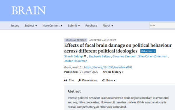 ⓒ데일리포스트=이미지 제공/Brain