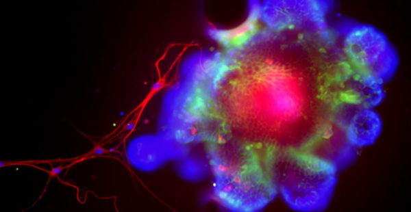 이 현미경 사진은 생쥐 소장을 모사한 장 오가노이드이다. 연구팀은 이 오가노이드 실험을 통해 알코올성 간 질환을 유발하는 새로운 기전의 존재를 확인했다. ⓒ데일리포스트=이미지 제공/UCSD