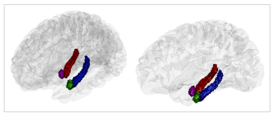해마와 편도체 3D 분할 시각화&nbsp;&nbsp;&nbsp;ⓒ데일리포스트=이미지 제공/Developmental Science