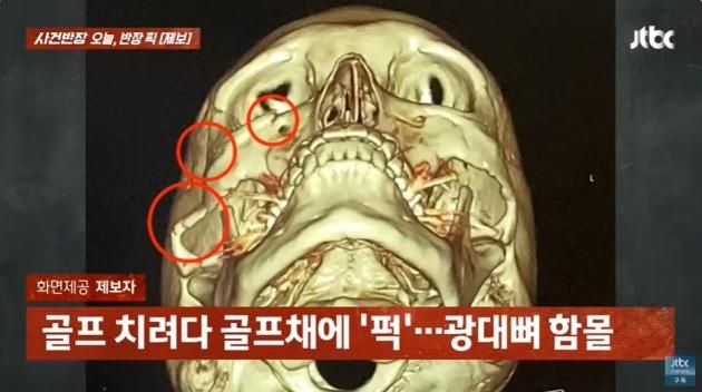 (JTBC '사건반장' 갈무리)