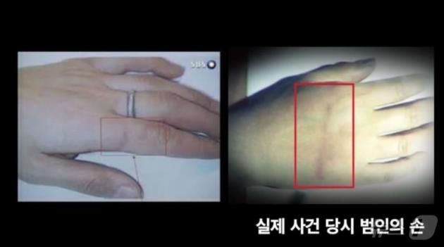 범인 이 시의 왼손등에 난 밧줄자국. (SBS 갈무리) ⓒ 뉴스1