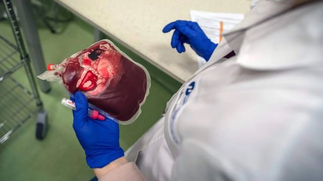 제대혈을 손에 들고 있는 사람