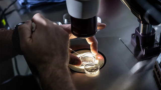 보조생식술을 진행하는 모습