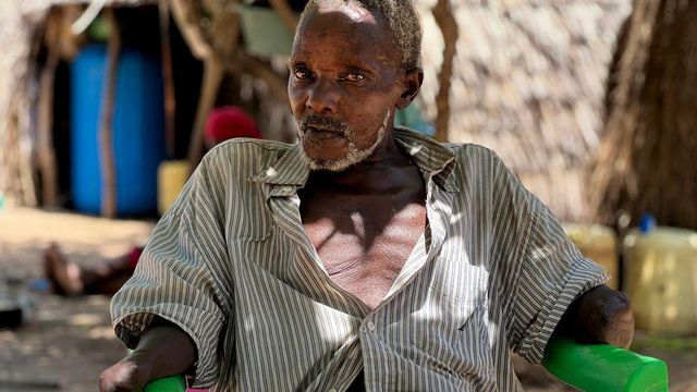 양손이 잘린 남성