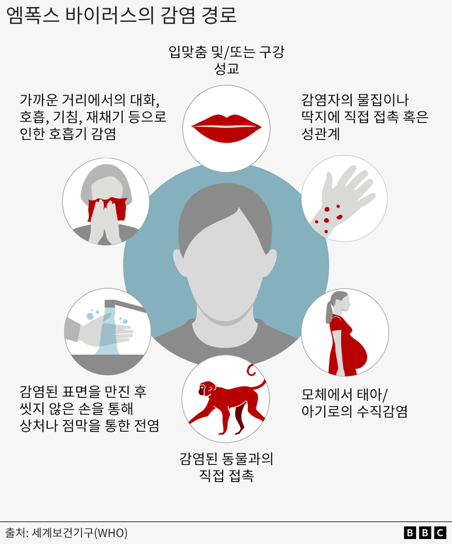 엠폭스 감염 경로