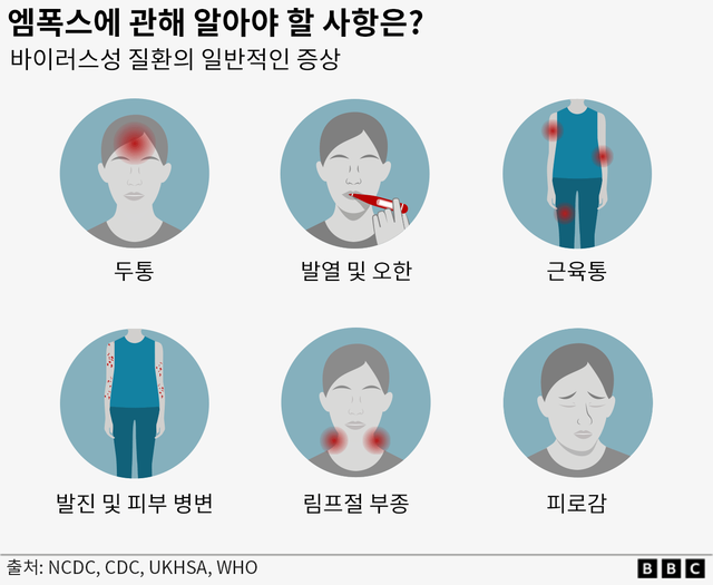 엠폭스 감염 증상