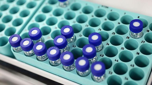 2012 런던 올림픽에 참가할 선수들의 샘플이 담긴 검사용 트레이