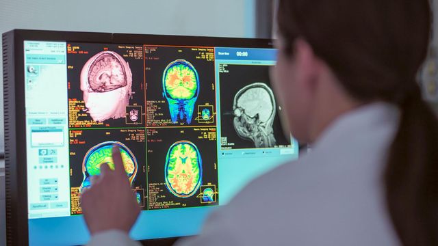 MRI 뇌 사진을 보고 있는 연구진의 모습