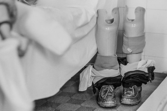 어린아이의 의족 흑백 사진