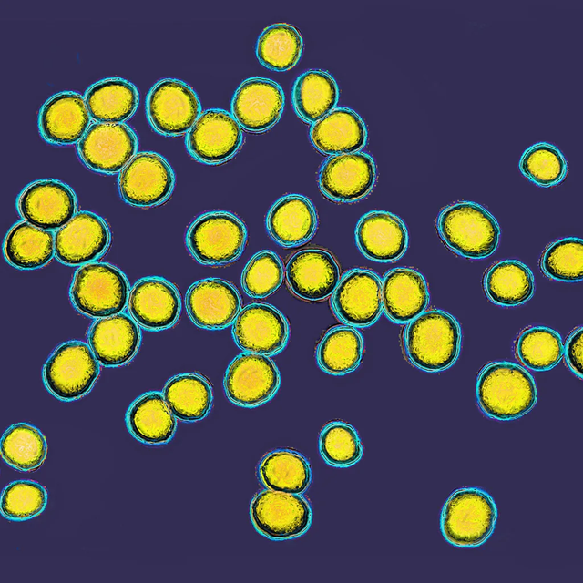 황색포도상구균을 현미경으로 확대해 찍은 사진