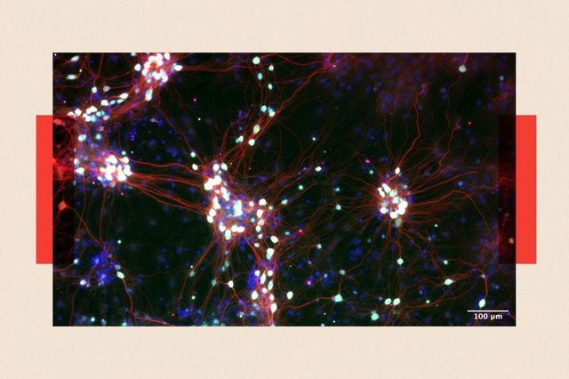 신경 세포를 근접 촬영한 모습