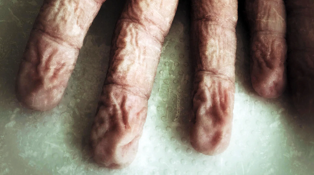 쭈글쭈글한 손가락 