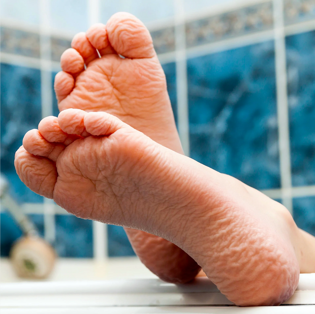 물 속에 담가서 쪼그라든 발