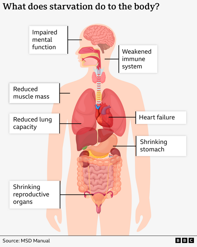 장기간의 굶주림이 신체에 미치는 영향
