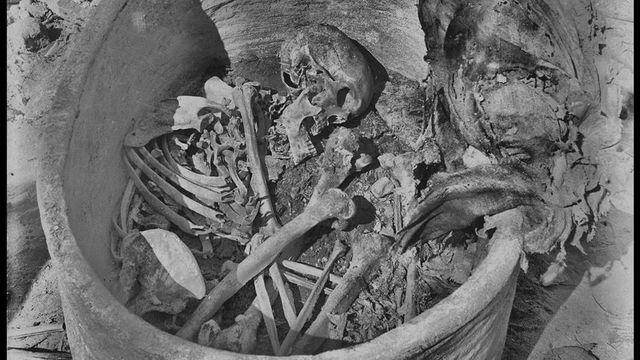 사람의 두개골을 포함한 여러 뼈들이 원형 용기에 담긴 채로 있는 모습을 흑백 사진으로 보여주고 있다