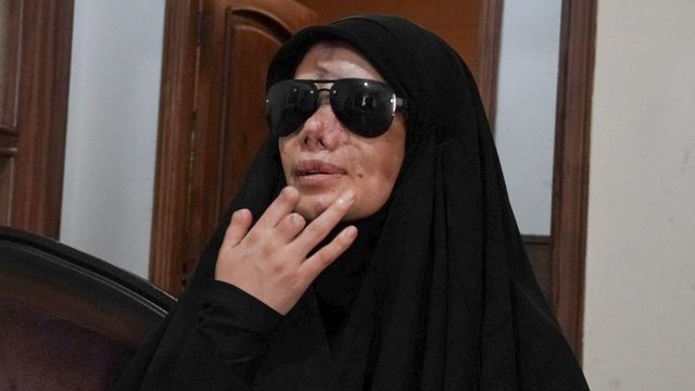 선글라스를 끼고 있는 나이페의 모습. 얼굴과 손에는 화상 흔적이 여전히 남아 있다