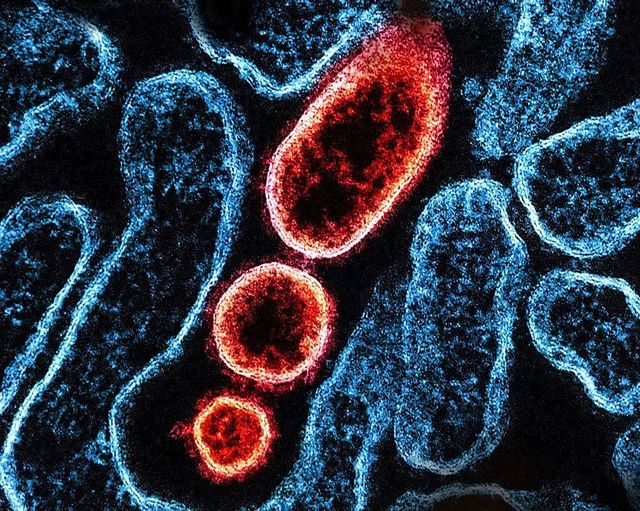 감염된 VERO 세포 주변부에서 포착된 니파 바이러스