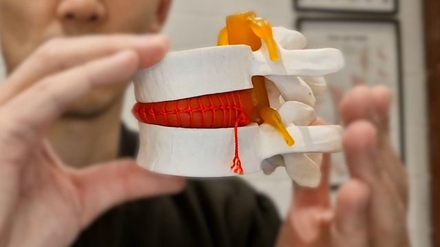 척추 관절 모형