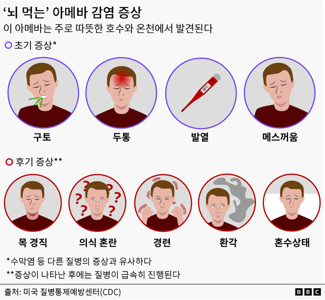 구토, 두통, 발열, 메스꺼움 / 목 경직, 의식 혼란, 발작, 환각, 혼수상태 등의 감염 증상