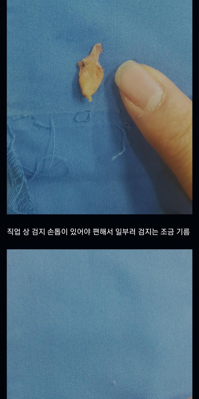 수많은 의사들이 포기한 불치병 치료 한 썰