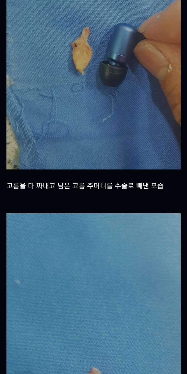 수많은 의사들이 포기한 불치병 치료 한 썰 2