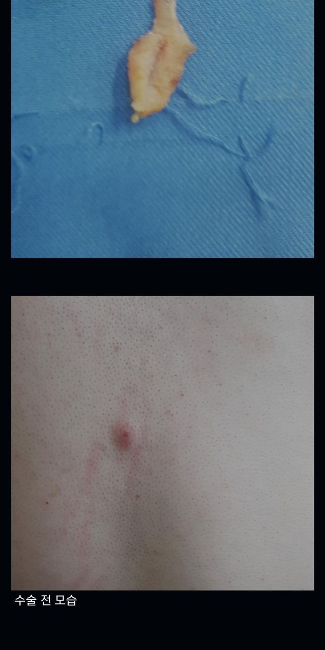 수많은 의사들이 포기한 불치병 치료 한 썰 3