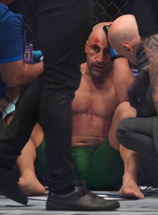 라이트급에서 마카체프에 패한 볼카노프스키. ⓒ AP=뉴시스