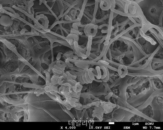 현미경으로 본 방선균 모습. ⓒ국립생물자원관