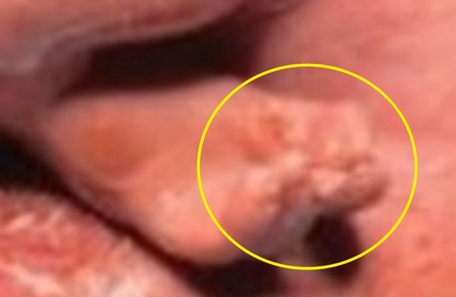 제거된 태아의 손ⓒ트위터 갈무리