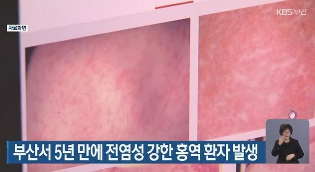 ⓒKBS 방송 캡처