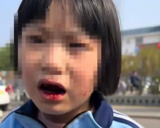 초등학생 딸이 동급생 7명에게 집단 폭행을 당했는데 아버지의 침착한 태도가 공분을 사고 있다. /사진=SCMP 캡처