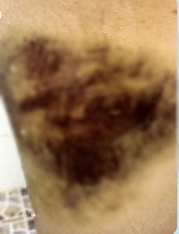  한 고등학교에서 태권도부에서 코치가 선수들을 폭행했다는 신고가 접수돼 관계당국이 사실을 확인하고 있다./사진=뉴시스(독자제공)