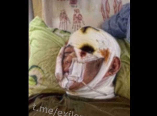 우크라이나와 교전 중 유일하게 살아남은 북한군으로 추정되는 영상이 텔레그램에 공개됐다. 사진은 해당 남성의 모습으로 부상 상태가 심각해 보인다. /사진=텔레그램 캡처