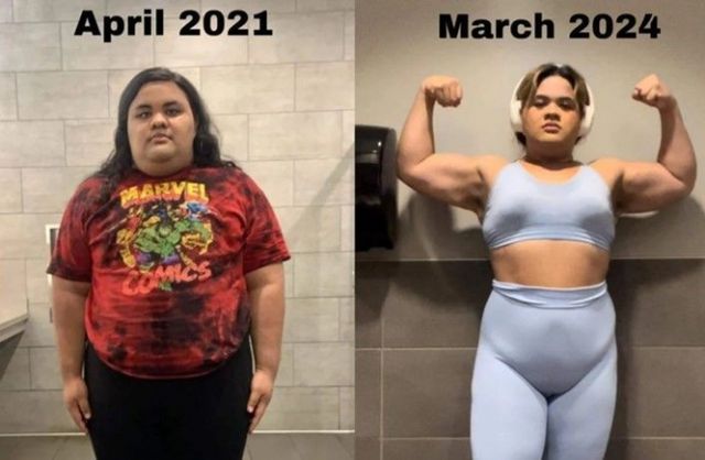 몸무게가 190㎏에 육박했던 20대 여성이 '체중 감량 수술'을 받고 약 70㎏를 뺐다는 사연이 알려졌다. /사진=사우스 차이나 모닝 포스트